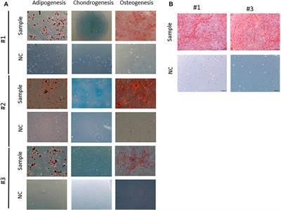 Senescence State in Mesenchymal Stem Cells at Low Passages: Implications in Clinical Use